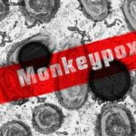 Cacar monyet atau monkeypox. (Foto: Istimewa)